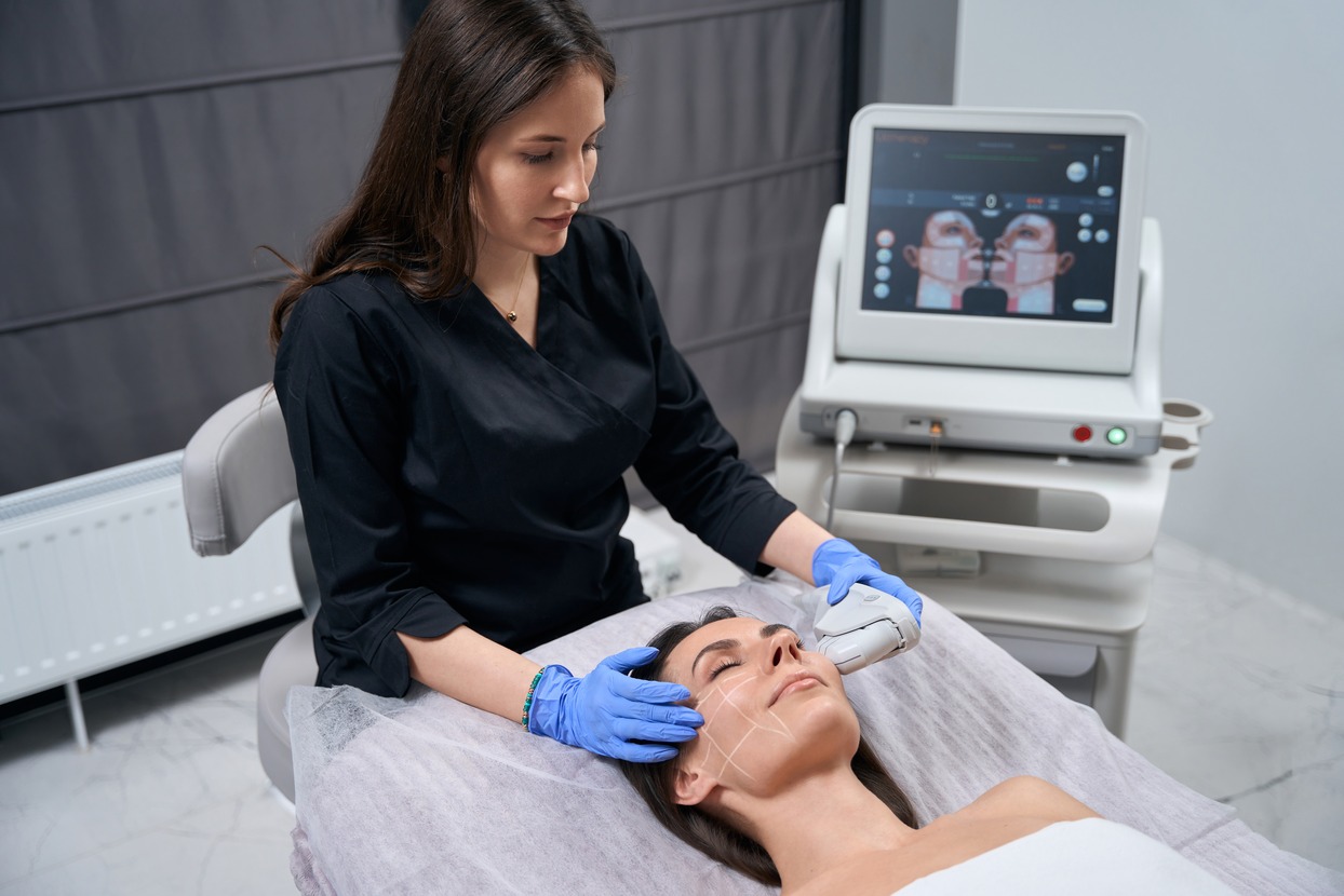 Ultherapy procedure