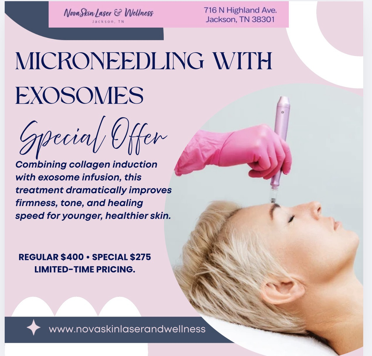 Microneedling with Exosomes